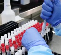 Após Réveillon, novas infecções por Covid-19 crescem cerca de 270% 