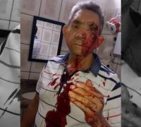 Professor agredido a socos por aluno de 14 anos relata medo: 