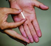 Entenda o que é o chip da beleza condenado por entidades médicas