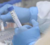 P1, a variante mais contagiosa do Coronavírus chega a Canarana