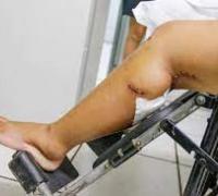 Homem tenta matar esposa a facadas em comunidade do município de Ibititá