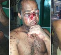 Chapada Diamantina: Padeiro é espancado por policiais militares e família pede justiça