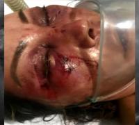 Mulher é agredida durante quatro horas em primeiro encontro