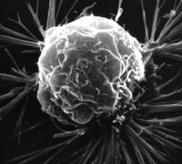 Em estudo, medicamento faz câncer desaparecer de todos os pacientes