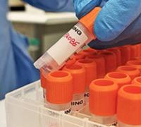 Sesab confirma primeiro caso de varíola dos macacos; paciente é morador de Salvador e já foi isolado