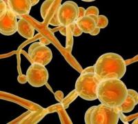 Brasil emite alerta sobre 1º caso de 