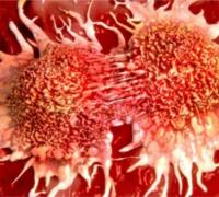 Uso indevido de agrotóxicos faz região de Irecê se aproximar dos primeiros no ranking do câncer