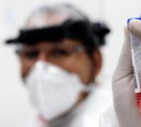 Relaxar isolamento na Bahia pode aumentar em até 50% as infecções por coronavírus, diz estudo