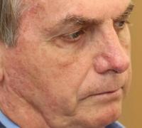 Após críticas, Bolsonaro revoga suspensão do contrato de trabalho por até 4 meses