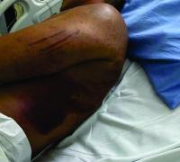 PMs tentaram matar major em curso e forjar causa por Covid, diz MPGO