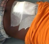 Garoto de seis anos esfaqueia irmão de oito em briga por estilingue