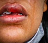 Morro do Chapéu: Por não aceitar fim do relacionamento, homem agride ex-mulher e acaba preso