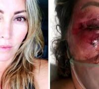 Preso por espancar mulher no Rio tem prisão preventiva decretada