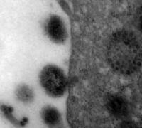 Fiocruz alerta que SRAG pode voltar a crescer